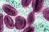 An impage of mpox virus cells, from NIH NIAD on flickr