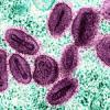 An impage of mpox virus cells, from NIH NIAD on flickr